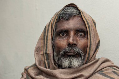 Sundarpur, Hindistan - 2013: Hindistan 'ın Bihar eyaletindeki yerel bir cüzzamlı hastanesinde kimliği belirsiz Hintli cüzzamlı hastalar