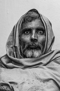 Sundarpur, Hindistan - 2013: Hindistan 'ın Bihar eyaletindeki yerel bir cüzzamlı hastanesinde kimliği belirsiz Hintli cüzzamlı hastalar