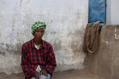 Sundarpur, Hindistan - 2013: Hindistan 'ın Bihar eyaletindeki yerel bir cüzzamlı hastanesinde kimliği belirsiz Hintli cüzzamlı hasta