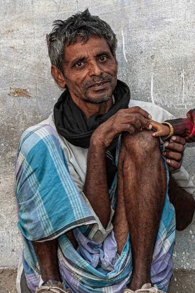 Sundarpur India 2013 Unidentified Indian Leprosy Patient Local Leprosy Hospital — 图库照片