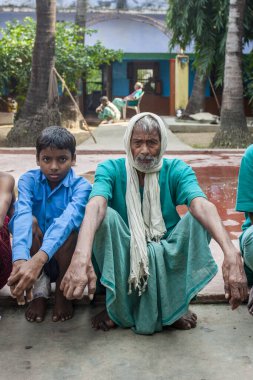 Sundarpur, Hindistan - 2013: Hindistan 'ın Bihar eyaletindeki yerel bir cüzzamlı hastanesinde kimliği belirsiz Hintli cüzzamlı hastalar