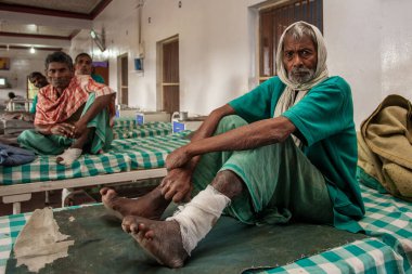 Sundarpur, Hindistan - 2013: Hindistan 'ın Bihar eyaletindeki yerel bir cüzzamlı hastanesinde kimliği belirsiz Hintli cüzzamlı hastalar