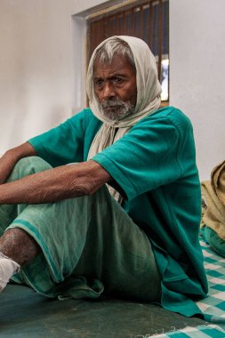 Sundarpur, Hindistan - 2013: Hindistan 'ın Bihar eyaletindeki yerel bir cüzzamlı hastanesinde kimliği belirsiz Hintli cüzzamlı hastalar