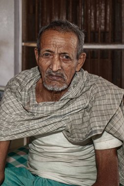 Sundarpur, Hindistan - 2013: Hindistan 'ın Bihar eyaletindeki yerel bir cüzzamlı hastanesinde kimliği belirsiz Hintli cüzzamlı hastalar