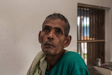 Sundarpur, Hindistan - 2013: Hindistan 'ın Bihar eyaletindeki yerel bir cüzzamlı hastanesinde kimliği belirsiz Hintli cüzzamlı hastalar