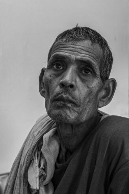 Sundarpur, Hindistan - 2013: Hindistan 'ın Bihar eyaletindeki yerel bir cüzzamlı hastanesinde kimliği belirsiz Hintli cüzzamlı hastalar