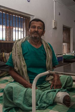 Sundarpur, Hindistan - 2013: Hindistan 'ın Bihar eyaletindeki yerel bir cüzzamlı hastanesinde kimliği belirsiz Hintli cüzzamlı hastalar