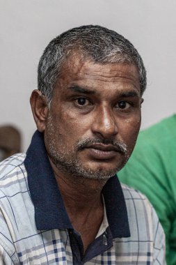 Sundarpur, Hindistan - 2013: Hindistan 'ın Bihar eyaletindeki yerel bir cüzzamlı hastanesinde kimliği belirsiz Hintli cüzzamlı hastalar