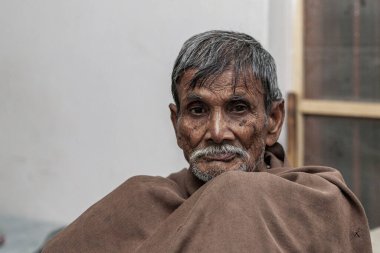 Sundarpur, Hindistan - 2013: Hindistan 'ın Bihar eyaletindeki yerel bir cüzzamlı hastanesinde kimliği belirsiz Hintli cüzzamlı hastalar