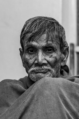 Sundarpur, Hindistan - 2013: Hindistan 'ın Bihar eyaletindeki yerel bir cüzzamlı hastanesinde kimliği belirsiz Hintli cüzzamlı hastalar