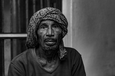 Sundarpur, Hindistan - 2013: Hindistan 'ın Bihar eyaletindeki yerel bir cüzzamlı hastanesinde kimliği belirsiz Hintli cüzzamlı hastalar