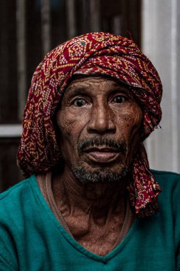 Sundarpur, Hindistan - 2013: Hindistan 'ın Bihar eyaletindeki yerel bir cüzzamlı hastanesinde kimliği belirsiz Hintli cüzzamlı hastalar