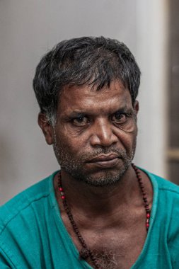 Sundarpur, Hindistan - 2013: Hindistan 'ın Bihar eyaletindeki yerel bir cüzzamlı hastanesinde kimliği belirsiz Hintli cüzzamlı hastalar