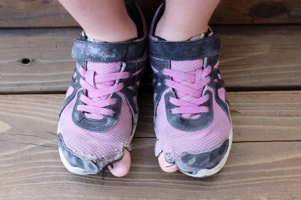 Velho Desgastado Sapatos com Buracos e Dedos — Fotografia de Stock
