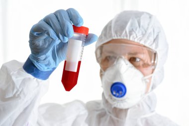 Bir laboratuarda kanla çalışan genç bir kadın bilim adamı.