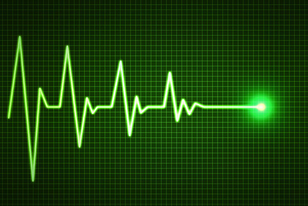 Конец жизни по линии сердечного ритма
