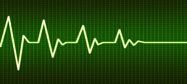 Heart beat line end of life — Stock Photo, Image