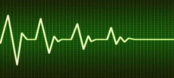 Конец жизни по линии сердечного ритма
