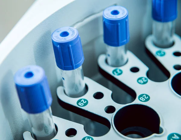 Medicinsk Utrustning Biokemi Test — Stockfoto