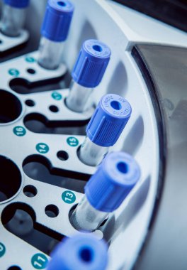 Tıbbi ekipman. Biyokimya testi.