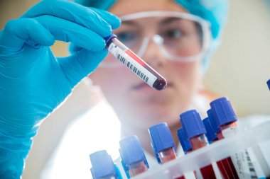 Laboratuvar çalışmalarında güler Medic personeli. Kan testi ile boruları.