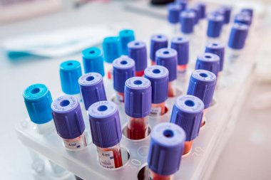 Tıbbi malzeme. Kan testi