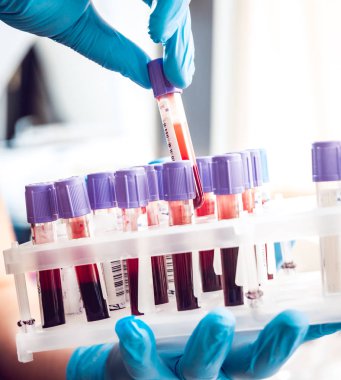 Tıbbi malzeme. Kan testi