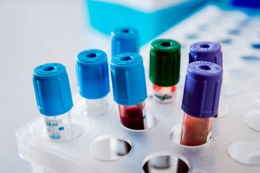 Tıbbi malzeme. Tüpler ve kapsayıcılar için kan testi.