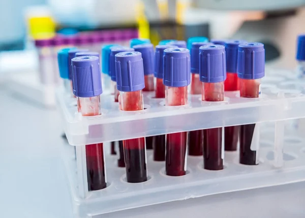 医疗设备 血液测试 — 图库照片