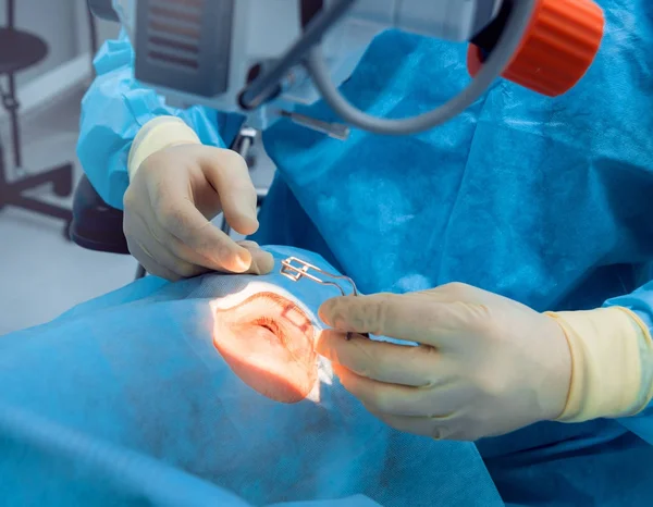 Werking Het Oog Cataract Chirurgie — Stockfoto