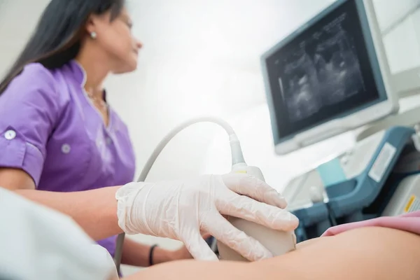 Scanner Ultra Som Nas Mãos Médico Diagnóstico Sonografia — Fotografia de Stock