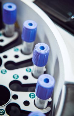 Tıbbi ekipman. Biyokimya testi.