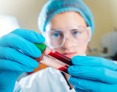 Laboratuvar çalışmalarında güler Medic personeli. Kan testi ile boruları.