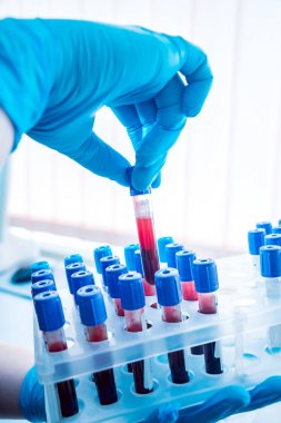 Tıbbi malzeme. Kan testi