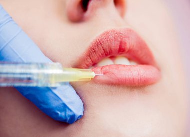 Güzel sarışın beyaz kız almak enjeksiyon estetik tıp kliniğinde.