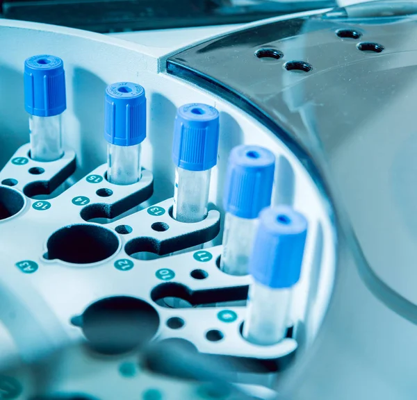 Tıbbi ekipman. Biyokimya testi.