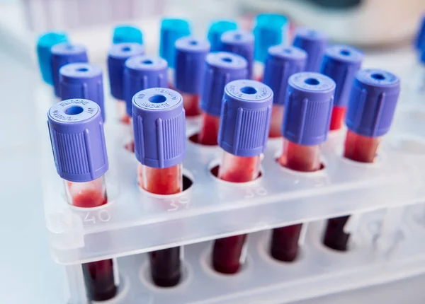 医疗设备 血液测试 — 图库照片