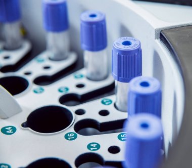 Tıbbi ekipman. Biyokimya testi.