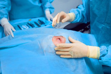 Kadın kıdemli çalışma gözde. Katarakt ameliyatı. Tıbbi donatımı. 