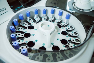 Tıbbi ekipman. Biyokimya testi.