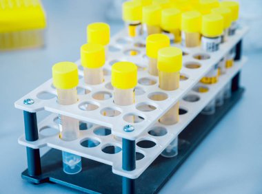 Tıbbi malzeme. Renkli tüpler arka plan