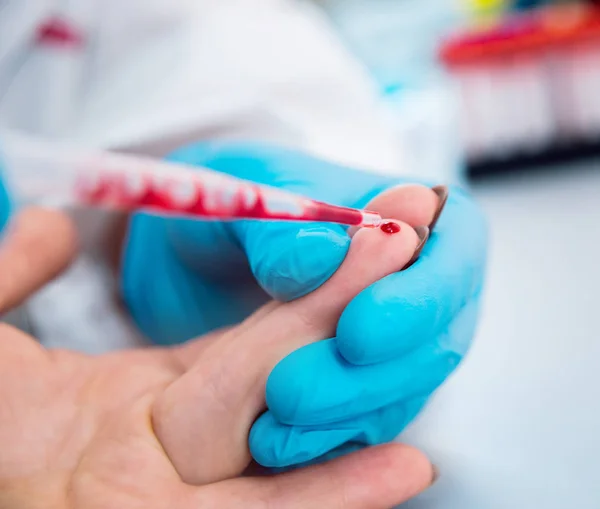Echipament Medical Testul Sânge — Fotografie, imagine de stoc