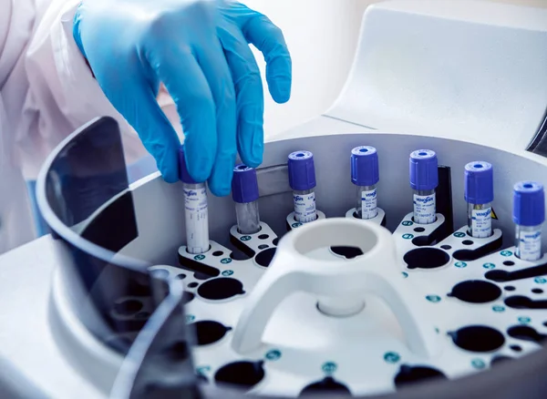 Medical Equipment Biochemistry Test — Stock Photo, Image
