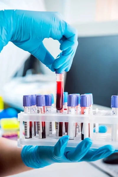 Tıbbi malzeme. Kan testi