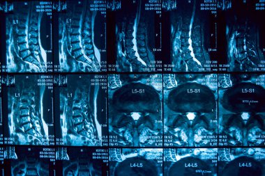 Tıbbi malzeme. Mr'ı resim. 