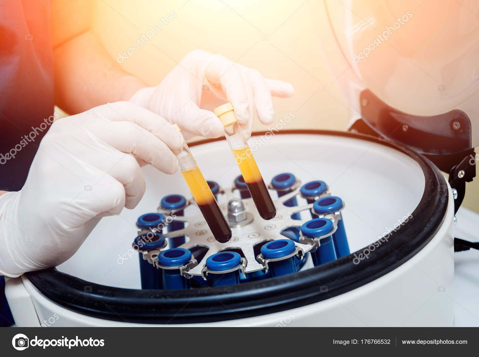 Platelet Rich Fibrin | PRF Treatment | Frisco, Plano, \u0026 Prosper, image size:1600x1193