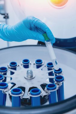 Tıbbi Laboratuar santrifüj tüpleri ile