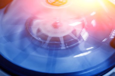 Trombosit zengini plazma hazırlığı. Santrifüjde kan olan tüp.