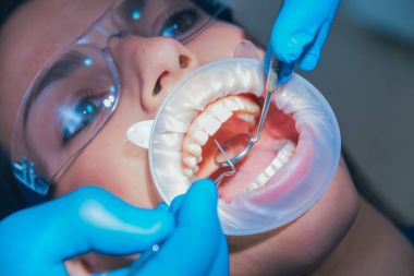 Expander ile diş tedavisi. 