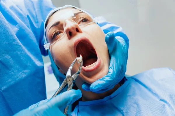 Dentista Usando Alicate Cirúrgico Para Remover Dente Decomposição Clínica Odontológica — Fotografia de Stock